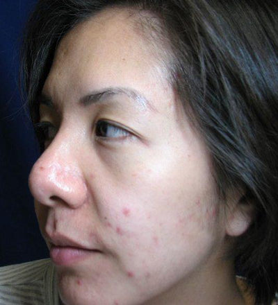 Before photo for Sarah M.