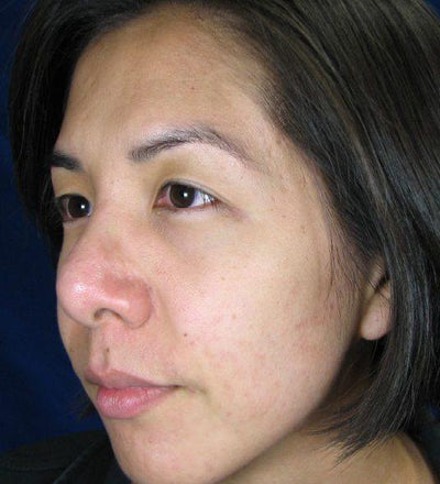 After photo for Sarah M.