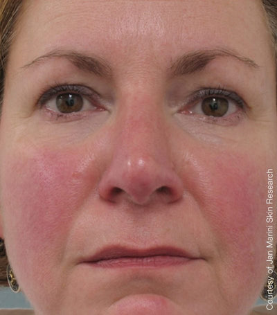 Before photo for Emma L.