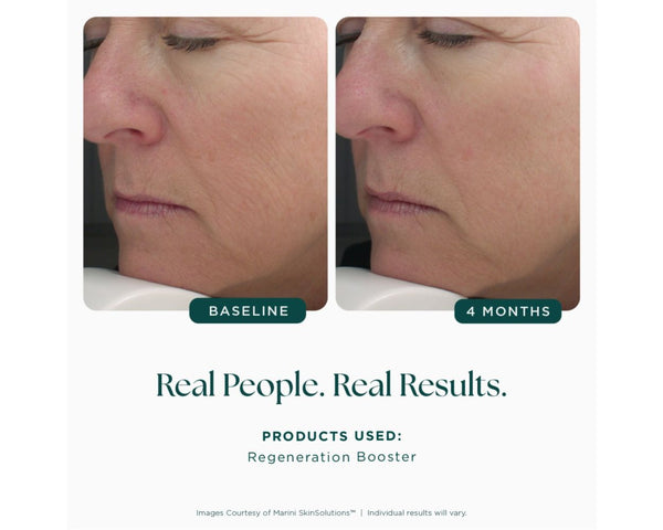 Regeneration Booster