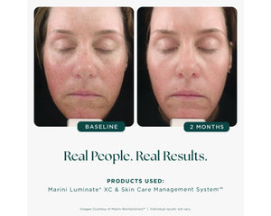 Marini Luminate® XC - 1 fl. oz.