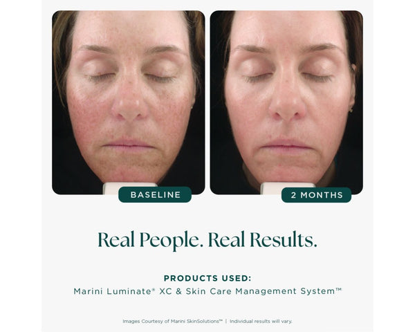 Marini Luminate® XC - 1 fl. oz.