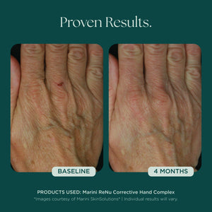 Marini ReNu Hand Complex
