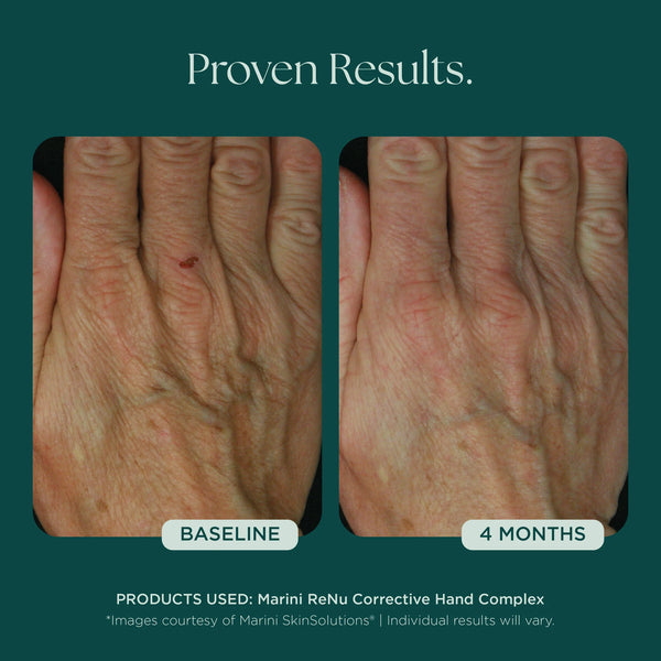Marini ReNu Hand Complex